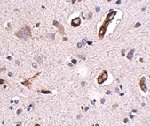 Antibody product image
